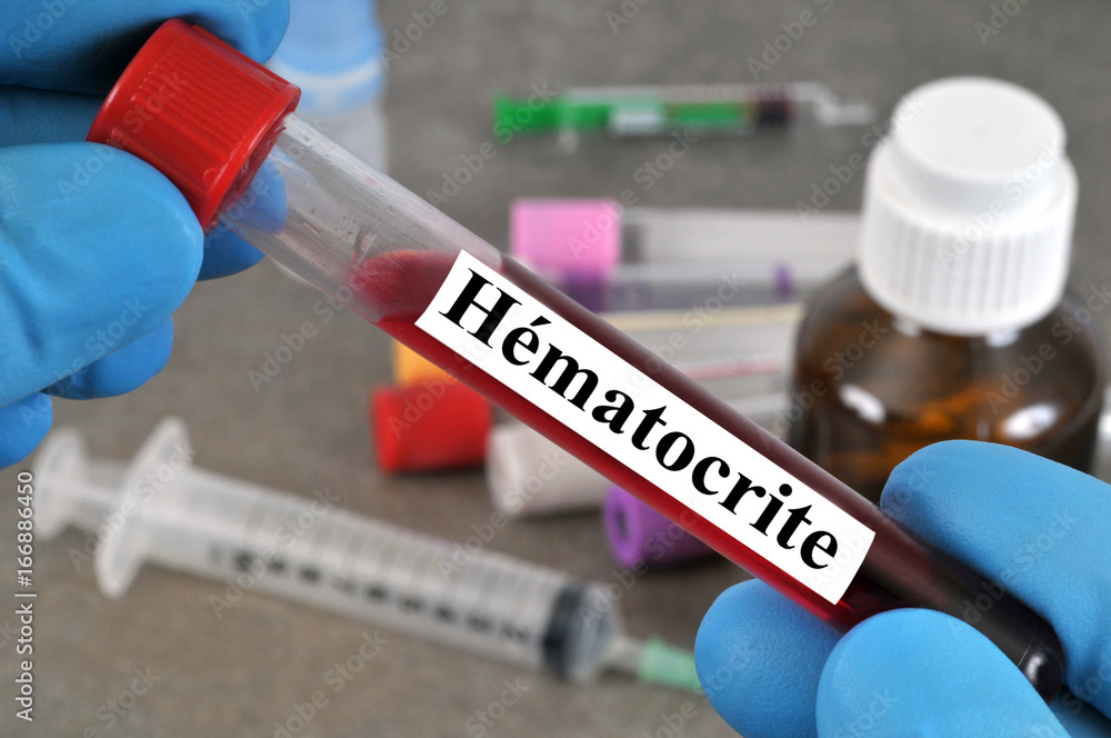 Comment Faire Pour Avoir Un Bon Taux D'hématocrite