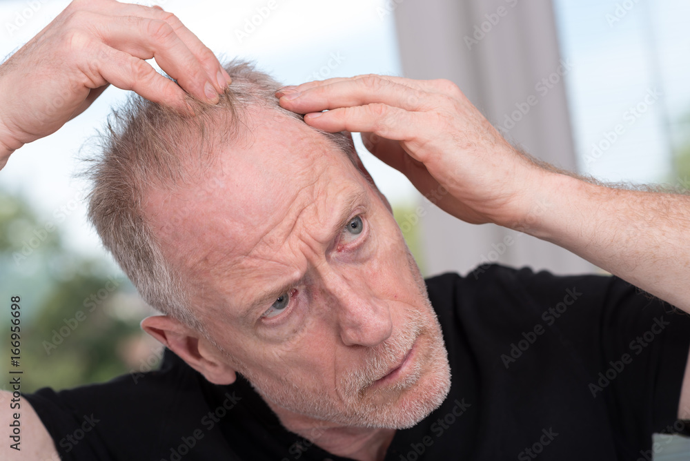 Obraz premium Senior man with hair concern