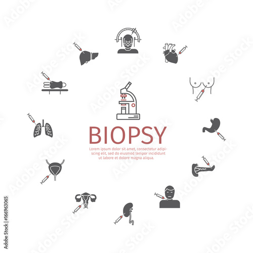 Biopsy: Types of biopsy procedures used to diagnose cancer photo