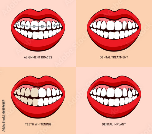 Dentist service. Teeth whitening, braces, treatment and dental implants. Vector illustration
