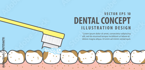 Banner Brushing very dirty teeth and gum illustration vector on blue background. Dental concept.