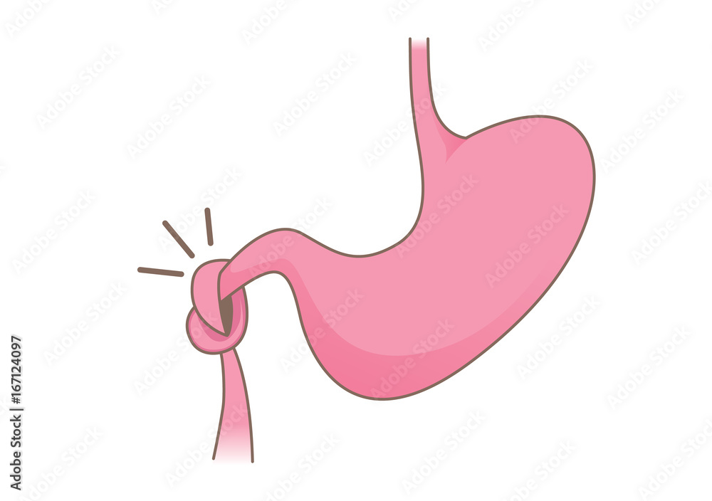 Have knot in stomach on isolated. Illustration about indigestion symptom and Gastrointestinal. Have knot in stomach on isolated. Illustration about indigestion symptom and Gastrointestinal.