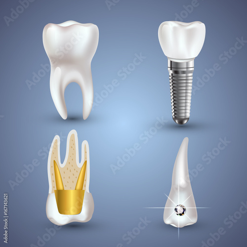 Vector set of 3d realistic clean and dirty tooth isolated on gray background. Dental health Concept. Oral Care, teeth restoration