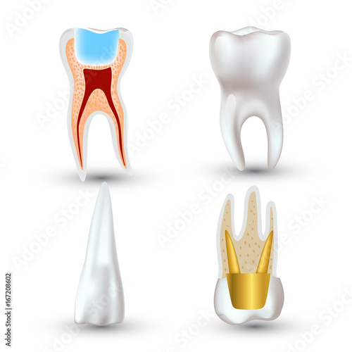 Vector set of 3d realistic clean and dirty tooth isolated on white background. Dental health Concept. Oral Care, teeth restoration