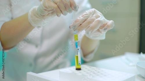 Injection of Plasma into a syringe