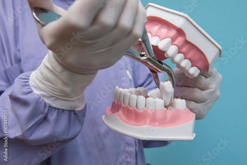 The dental model is used to Demonstration of tooth extraction by doctors. Blue background.