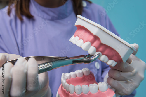The dental model is used to Demonstration of tooth extraction by doctors. Blue background.