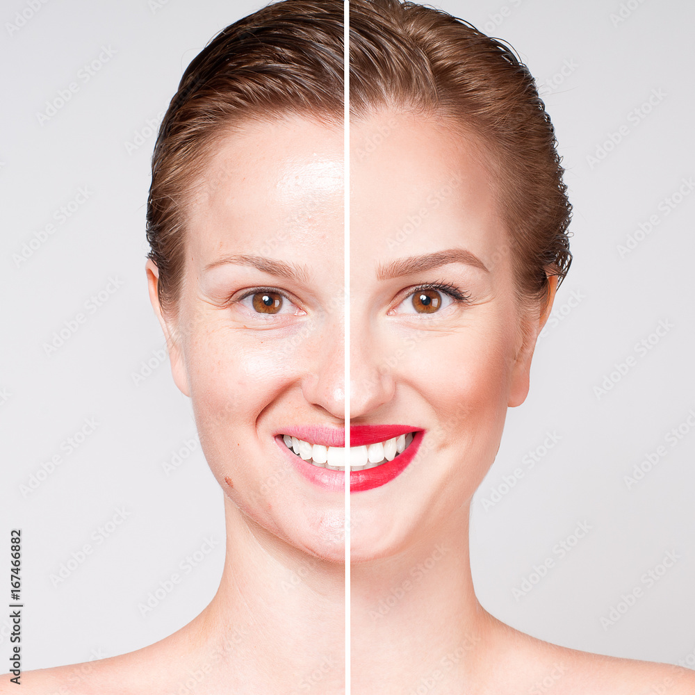 Woman before and after cosmetic or plastic procedure Woman before and after cosmetic or plastic procedure