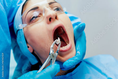 Fotografia Dentist using surgical pliers to remove a decaying tooth