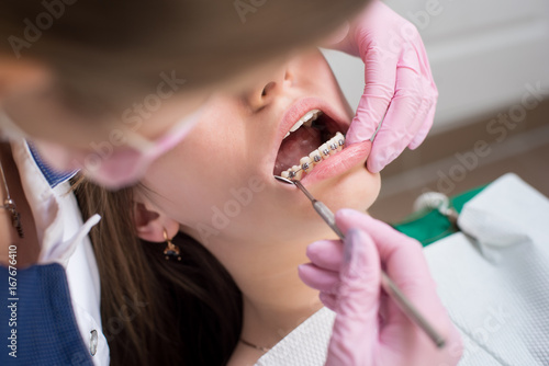 Female dentist checking up patient teeth with metal brackets at dental clinic office. Medicine, dentistry and health care concept. Dental equipment