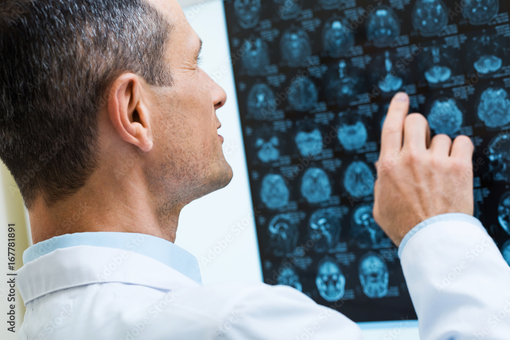 Fototapeta premium Male doctor looking through computer tomography results