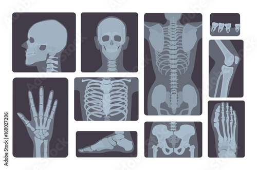 Realistic x-ray shots collection. Human body hand, leg, skull, foot, chest, teeth, spine and other.
