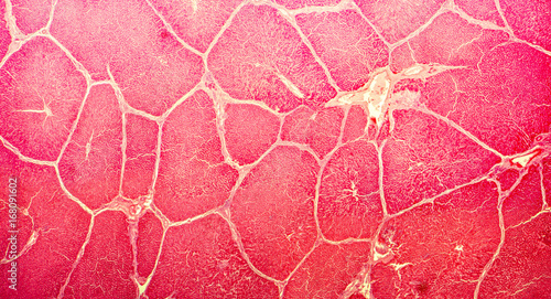 Light micrograph of a liver showing cords made from hepatocytes and clear space between them called hepatic sinusoids and filled with red blood cells. Magnification 40x photo