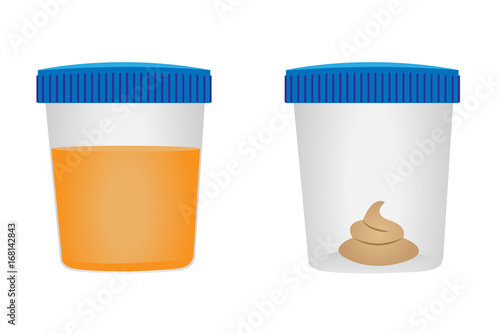 Stool and urina test. Medical examination.