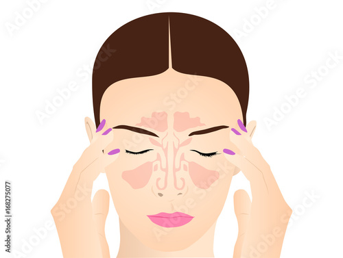 Sinus Inflammation