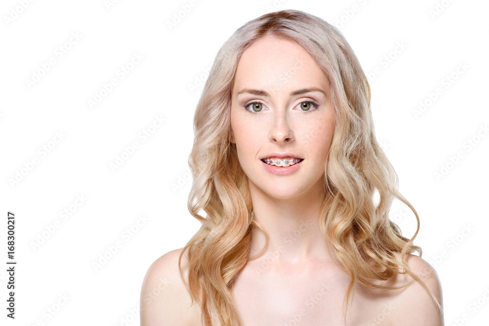 Young woman with braces Young woman with braces