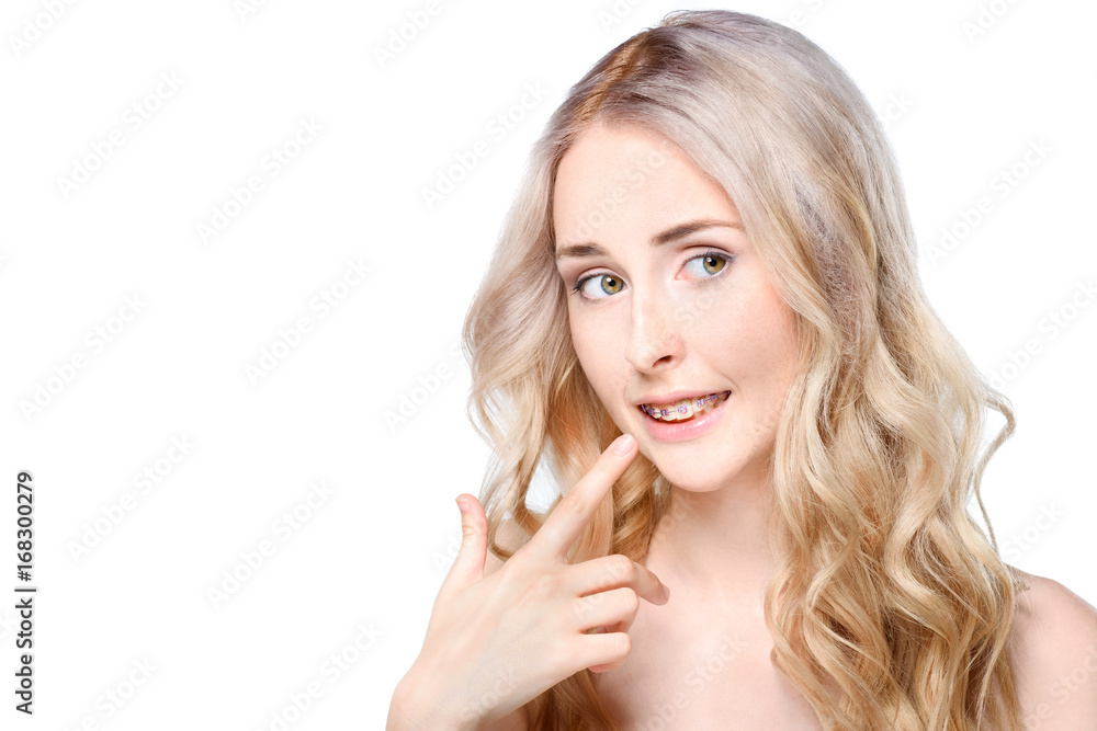 Woman pointing to teeth with braces Woman pointing to teeth with braces
