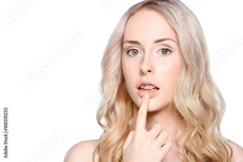 Woman pointing to teeth with braces