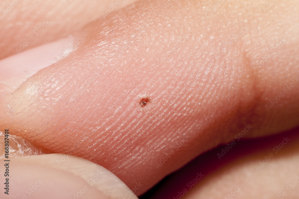 Macro picture take off stigma on finger baby Macro picture take off stigma on finger baby