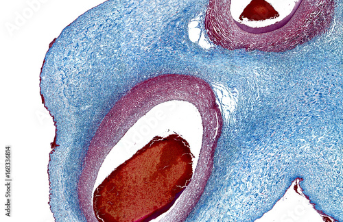 Histology umbilical cord tissue photo