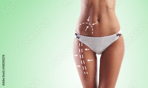 Women slim body in swimwear having arrows along her stomach and legs. Fat lose, liposuction and cellulite removal concept.