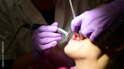 A young woman removes caries of teeth at the dentist