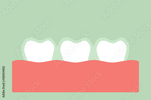 teeth wear silicone trainer or invisible braces
