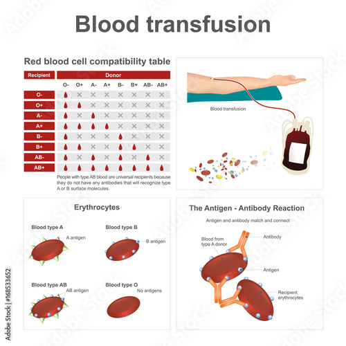 Blood transfusion. There are two special blood types when it comes to blood transfusions. Info graphic vector.