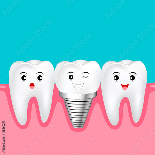 Two healthy teeth and implant tooth between. Funny cartoon character design. Human tooth implant concept, Illustration.
