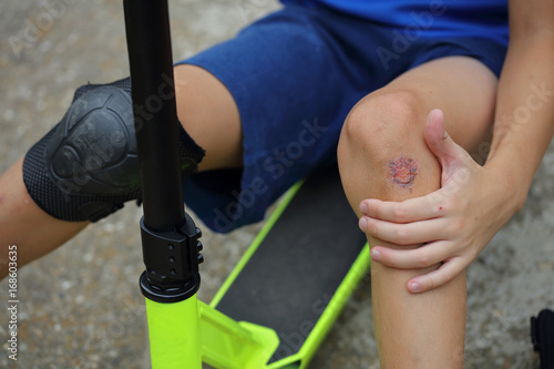 Photography Child with a scraped knee