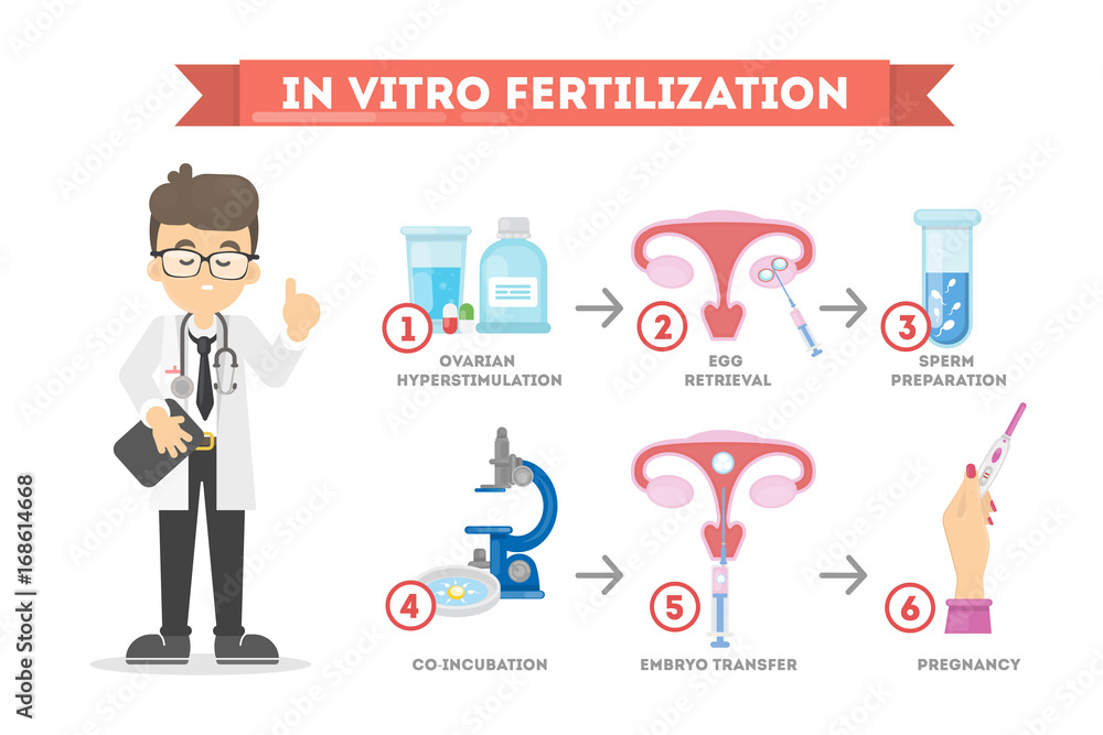 In vitro fertilization. In vitro fertilization.