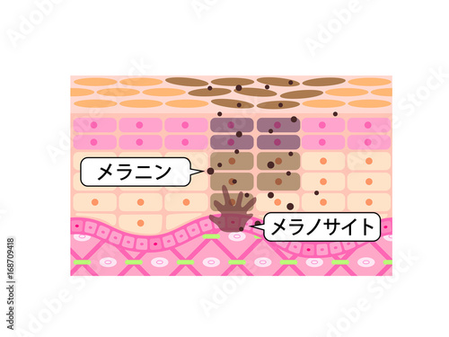 肌　断面図　日焼け　シミ