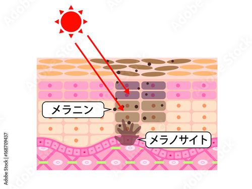 肌　断面図　日焼け　シミ