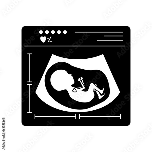 black silhouette of ultrasound of baby