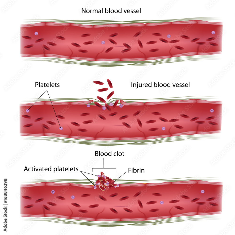 Blood clotting process Stock Illustration | Adobe Stock