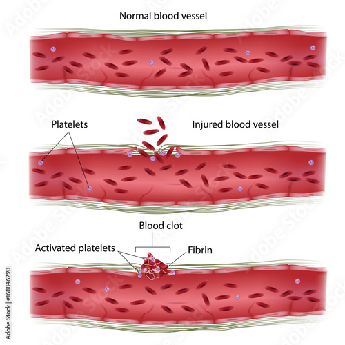 Blood clotting process photo