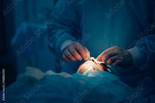 Surgeon wearing gloves operates women's nose . Operation close up. photo