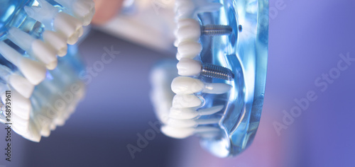 Dentistry teaching tooth model