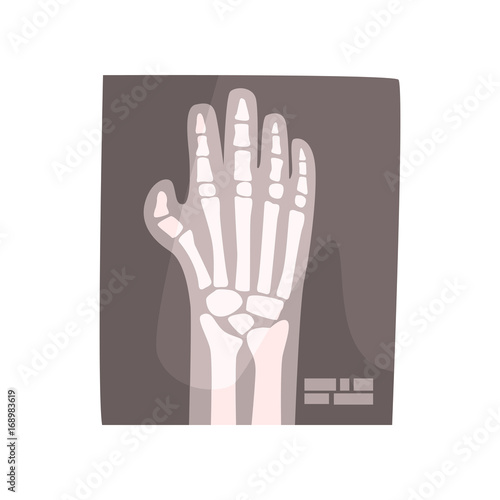 X ray image of human hand cartoon vector Illustration