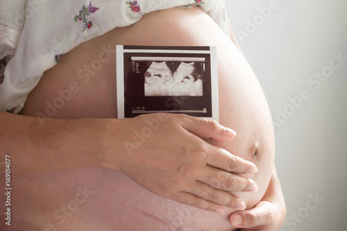 Closeup pregnant woman holding ultrasound scan.