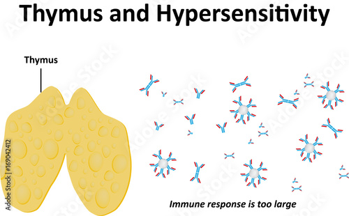Thymus and Hypersensitivity