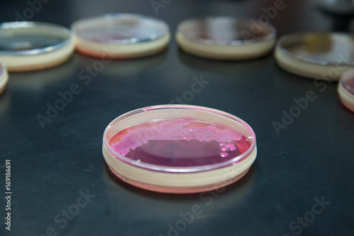 Close-up detail of an agar plate of Klebsiella pneumoniae on a laboratory tabletop, with multiple petri dishes in the background as an arc. Microbiology and medicine concept. photo