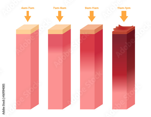 uv index . The infographic of ultraviolet burn human skin from 4am - 1 pm