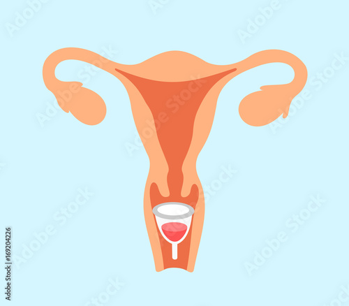 Menstrual cup - feminine hygiene product, device for collecting blood during menstruation and period is used inside the vagina of woman / female.