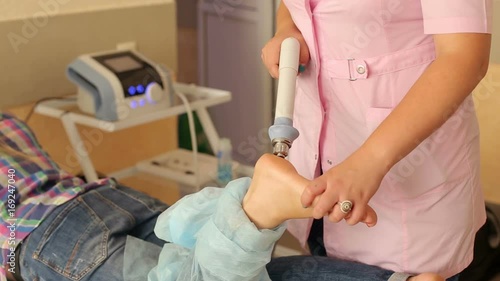 Close-up of a doctor doing shock wave therapy on a sore heel for a girl in a clinic. Physiotherapist doctor performs surgery on a patient's heel. Magnetic field, rehabilitation. Laser Therapy photo