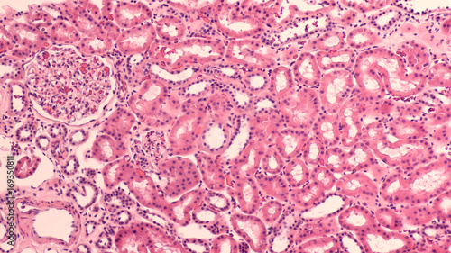 Kidney Histology: Histology of normal human kidney with collecting tubules and single glomerulus (left upper) photo