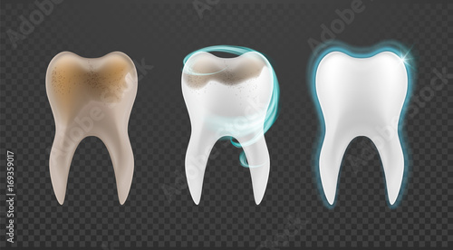 Human Teeth