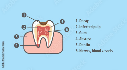Structure of tooth illustration vector on blue background. Dental concept.