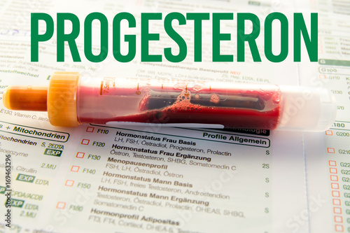 Progesteron / Blutprobe auf Laborzettel photo