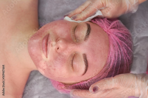 Hands of cosmetician, female face. Girl with problematic skin.